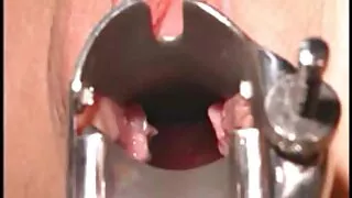 빌어 먹을 포로노 무료 후 백인 이웃에 흑인 배수구.